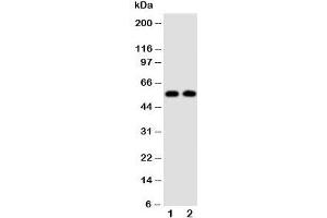 Western blot testing of Alpha Amylase 1 antibody and Lane 1:  rat liver;  2: rat intestine tissue lysate (Alpha-amylase 1 Antikörper  (N-Term))