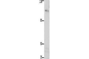 Western Blotting (WB) image for anti-PTK2 Protein tyrosine Kinase 2 (PTK2) antibody (ABIN2425840) (FAK Antikörper)