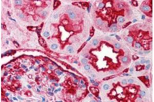 Human Kidney (formalin-fixed, paraffin-embedded) stained with TNFRSF12A antibody ABIN214532 at 2. (TNFRSF12A Antikörper)