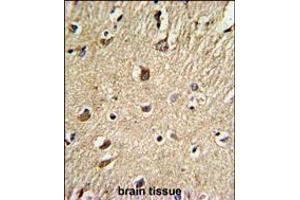 Formalin-fixed and paraffin-embedded human brain tissue reacted with BGN Antibody , which was peroxidase-conjugated to the secondary antibody, followed by DAB staining.