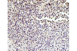 IHC analysis of SOX15 using anti-SOX15 antibody (ABIN6719624).