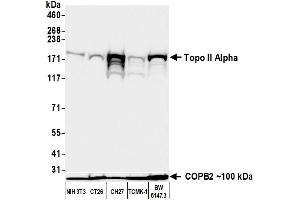 Western Blotting (WB) image for anti-Topo IIalpha (AA 650-700) antibody (ABIN7795794)