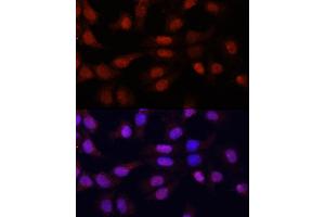 Immunofluorescence analysis of HeLa cells using N5-Methylcytidine antibody (ABIN1678489, ABIN3016020, ABIN3016022 and ABIN6219497) at dilution of 1:100. (5-Methylcytosine Antikörper)