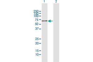 Western Blot analysis of HEXA expression in transfected 293T cell line by HEXA MaxPab polyclonal antibody. (Hexosaminidase A Antikörper  (AA 1-529))