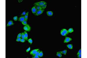 Immunofluorescent analysis of HepG2 cells using ABIN7171269 at dilution of 1:100 and Alexa Fluor 488-congugated AffiniPure Goat Anti-Rabbit IgG(H+L) (STXBP6 Antikörper  (AA 2-210))