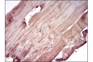Immunohistochemical analysis of paraffin-embedded human muscle tissues using PRL mouse mAb with DAB staining. (Prolactin Antikörper  (AA 65-173))