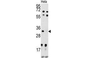 Western blot analysis of anti-UCK2 Antibody (N-term) pre-incubated with and without blocking peptide in Hela cell line lysate. (UCK2 Antikörper  (N-Term))