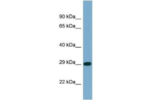 Western Blotting (WB) image for anti-Protein Phosphatase 2, Catalytic Subunit, alpha Isozyme (PPP2CA) (N-Term) antibody (ABIN2786564) (PPP2CA Antikörper  (N-Term))