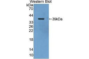 Western blot analysis of the recombinant protein. (Nuclear Factor kappa B2 (AA 37-342) Antikörper)