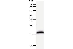 Western Blotting (WB) image for anti-CREB Binding Protein (CREBBP) antibody (ABIN932995) (CBP Antikörper)