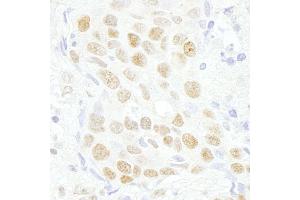 Immunohistochemistry (IHC) image for anti-MYC-Associated Zinc Finger Protein (Purine-Binding Transcription Factor) (MAZ) (AA 427-477) antibody (ABIN7448642)