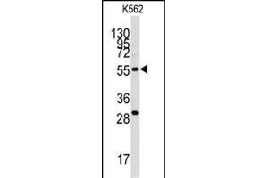 Western blot analysis of anti-CLIC5 Antibody (ABIN391843 and ABIN2841681) in K562 cell line lysates (35 μg/lane). (CLIC5 Antikörper)