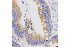 Immunohistochemistry (IHC) image for anti-Pepsinogen C (PGC) (AA 100-200) antibody (ABIN6219816) (PGC Antikörper  (AA 100-200))