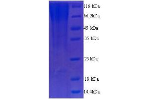 SDS-PAGE (SDS) image for Receptor Tyrosine Kinase-Like Orphan Receptor 1 (ROR1) (AA 30-391), (Extracellular) protein (His tag) (ABIN5713798)