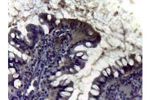 Immunohistochemistry of Rabbit anti Carbonic Anhydrase II antibody Tissue: intestine Staining: diffuse positivity of enzyma Carbonic Anidrase II in brush border of villus (CA2 Antikörper)