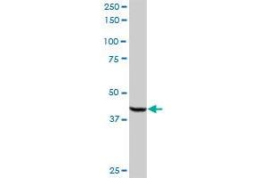 ACOX2 MaxPab rabbit polyclonal antibody. (Acox2 Antikörper  (AA 1-681))