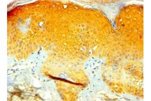 Immunohistochemistry of paraffin-embedded human skin tissue using ABIN7171970 at dilution of 1:100 (TIAF1 Antikörper  (AA 1-115))