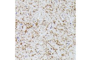 Immunohistochemistry of paraffin-embedded human brain using CLN8 antibody (ABIN7266285) at dilution of 1:300 (40x lens). (CLN8 Antikörper)