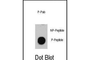 Dot blot analysis of anti-Phospho-ATM-p Antibody (ABIN389888 and ABIN2839734) on nitrocellulose membrane. (ATM Antikörper  (pSer1981))