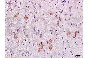 Formalin-fixed and paraffin embedded rat brain tissue labeled with Anti-APC/Adenomatous Polyposis Coli Polyclonal Antibody, Unconjugated (ABIN702550) at 1:200 followed by conjugation to the secondary antibody, (SP-0023), and DAB staining (APC Antikörper  (AA 2751-2843))