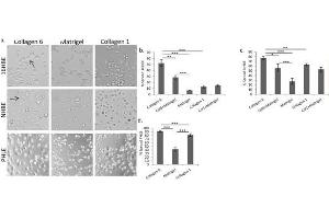 Image no. 8 for Collagen, Type VI (COL6) protein (ABIN5624600)