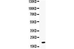 Western blot analysis of NAP2 expression in MCF-7 whole cell lysates (lane 1). (CXCL7 Antikörper  (AA 55-128))