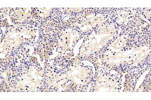 Immunohistochemistry (IHC) image for anti-Transferrin (TF) (AA 361-683) antibody (ABIN7429184)