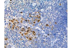 ABIN6255252 and ABIN6267093 at 1/100 staining Mouse spleen tissue by IHC-P. (ATG13 Antikörper  (pSer355))