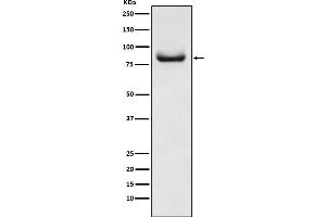 Western Blotting (WB) image for anti-Adaptor Protein, phosphotyrosine Interaction, PH Domain and Leucine Zipper Containing 1 (APPL1) antibody (ABIN7607000)