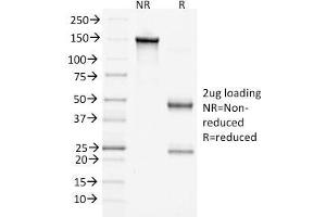 SDS-PAGE Analysis of Purified Beta-Catenin Mouse Monoclonal Antibody (15B8).