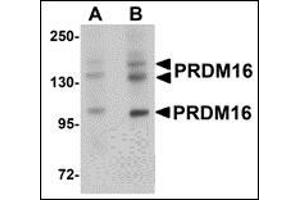 Western blot analysis of PRDM16 in rat brain tissue lysate with AP30689PU-N PRDM16 antibody at (A) 1 and (B) 2 μg/ml.
