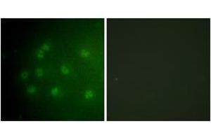 Immunofluorescence analysis of COS7 cells, using Retinoblastoma (Phospho-Thr826) Antibody.