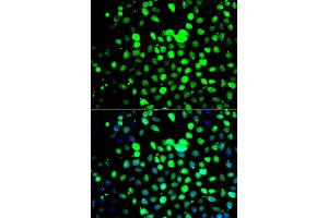 Immunofluorescence analysis of A549 cell using ZBTB25 antibody. (ZBTB25 Antikörper)
