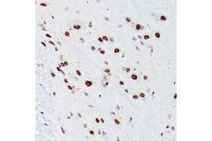 Immunohistochemistry of paraffin-embedded Mouse spinal cord using NSUN5 antibody ( ABIN7268955) at dilution of 1:100 (40x lens). (NSUN5 Antikörper  (AA 277-466))