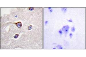 Immunohistochemistry analysis of paraffin-embedded human brain, using GRK1 (Phospho-Ser21) Antibody. (GRK1 Antikörper  (pSer21))