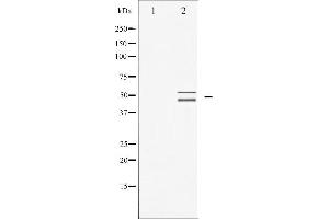 Western blot analysis of VASP expression in NIH-3T3 whole cell lysates,The lane on the left is treated with the antigen-specific peptide.