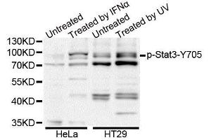 Western blot analysis of extracts of HT-29 cell line, using Phospho-Stat3-Y705 antibody. (STAT3 Antikörper  (pTyr705))