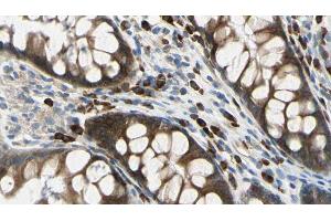 ABIN6272628 at 1/100 staining Rat colon tissue by IHC-P. (ADAM8 Antikörper  (Internal Region))
