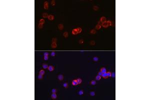 Immunofluorescence analysis of TF-1 cells using J Rabbit pAb (ABIN6134375, ABIN6142642, ABIN6142643 and ABIN6213974) at dilution of 1:50 (40x lens).