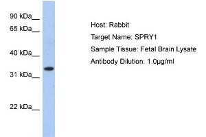 Western Blotting (WB) image for anti-Sprouty Homolog 1, Antagonist of FGF Signaling (SPRY1) (N-Term) antibody (ABIN2784216)