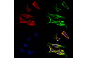ABIN6259847 and ABIN6277044 staining Hela cells by IF/ICC. (AK4 Antikörper  (Internal Region))
