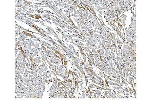 IHC analysis of ARF6 using anti-ARF6 antibody (ABIN4886473).