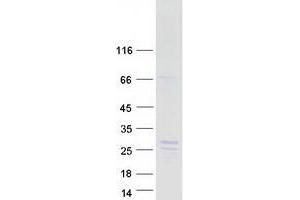 Western Blotting (WB) image for Neuroblastoma 1, DAN Family BMP Antagonist (NBL1) (Transcript Variant 2) protein (Myc-DYKDDDDK Tag) (ABIN2726864)