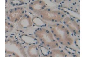 Immunohistochemistry (IHC) image for anti-ATPase, Na+/K+ Transporting, beta 3 Polypeptide (ATP1B3) (AA 61-273) antibody (ABIN7440134)