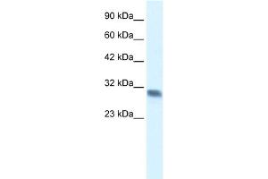 WB Suggested Anti-FHL2 Antibody Titration:  0. (FHL2 Antikörper  (C-Term))