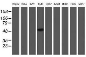 Image no. 10 for anti-NADH Dehydrogenase (Ubiquinone) Complex I, Assembly Factor 7 (NDUFAF7) antibody (ABIN1499667) (NDUFAF7 Antikörper)
