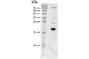 Western Blotting (WB) image for Bromodomain Containing 3 (BRD3) (AA 24-144) protein (His tag,DYKDDDDK Tag) (ABIN2669644)