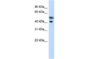 Tropomodulin 2 antibody used at 1 ug/ml to detect target protein. (TMOD2 Antikörper)