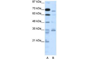 WB Suggested Anti-PCSK6 Antibody Titration:  2. (PCSK6 Antikörper  (N-Term))