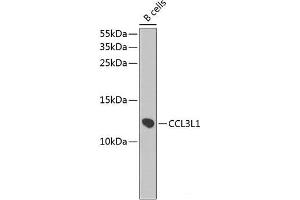 Western blot analysis of extracts of B-cell cells using CCL3L1 Polyclonal Antibody at dilution of 1:1000. (CCL3L1 Antikörper)